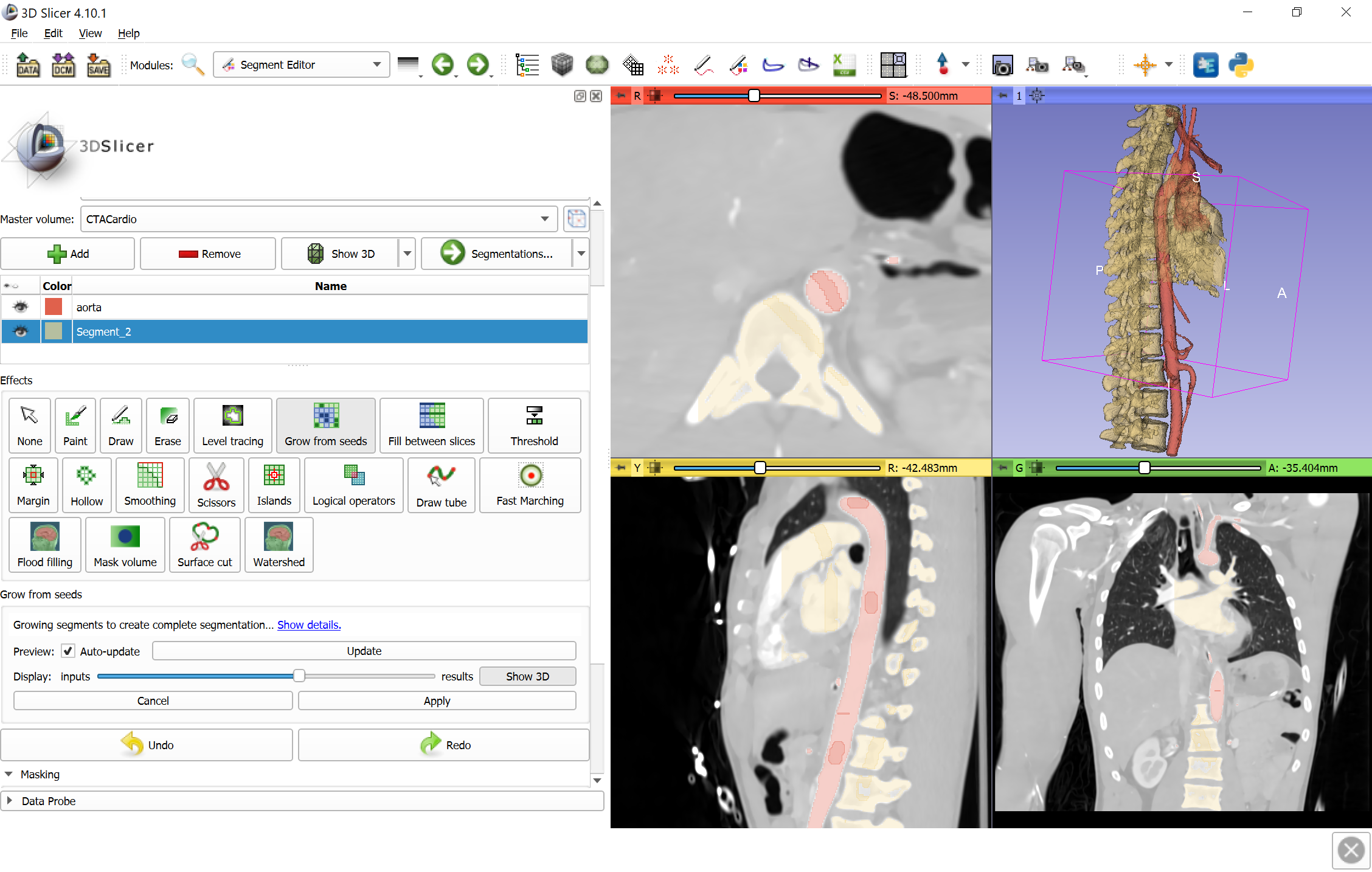 Preview segmentation result in 3D.