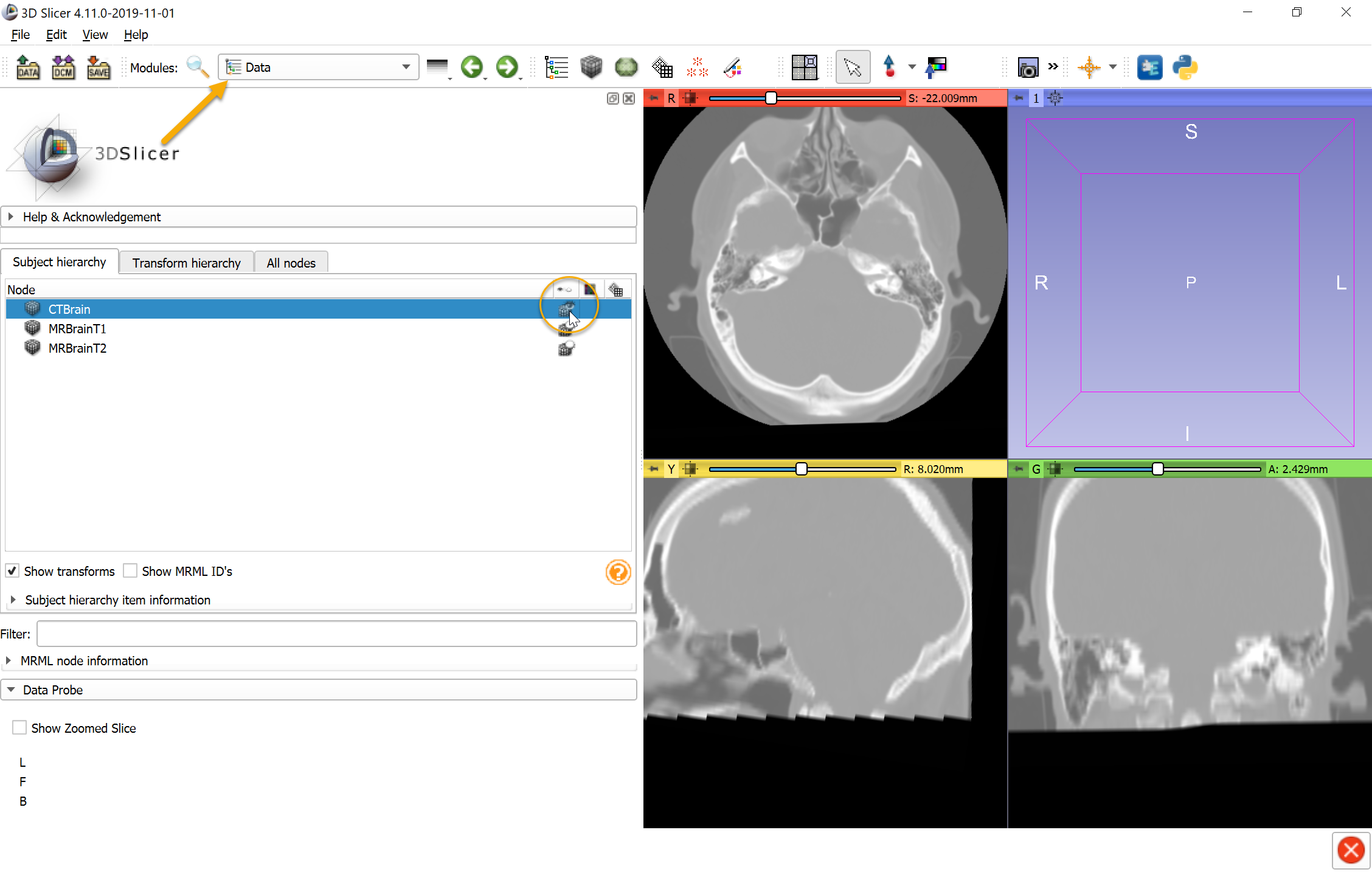 Head CT image.