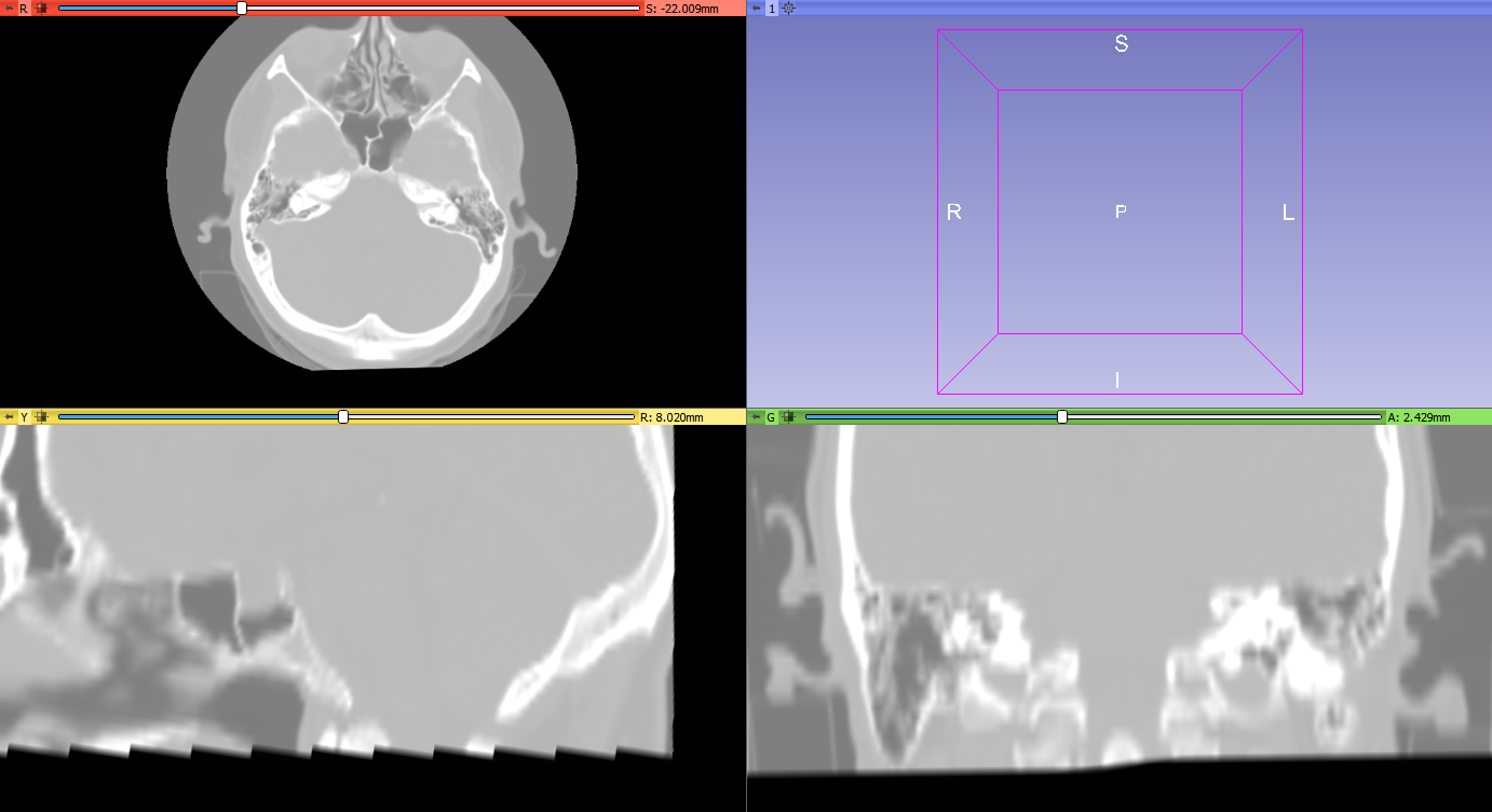 Head CT image.