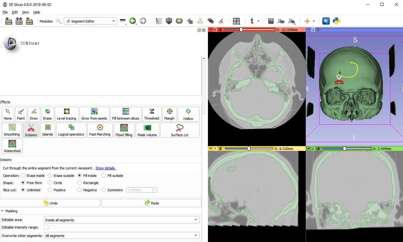 Slicer 3d. Slicer 3d Интерфейс. 3d Slicer описание. 3d Slicer CT. Orca slicer настройка