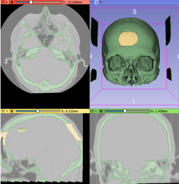 Skull separated into two segments.