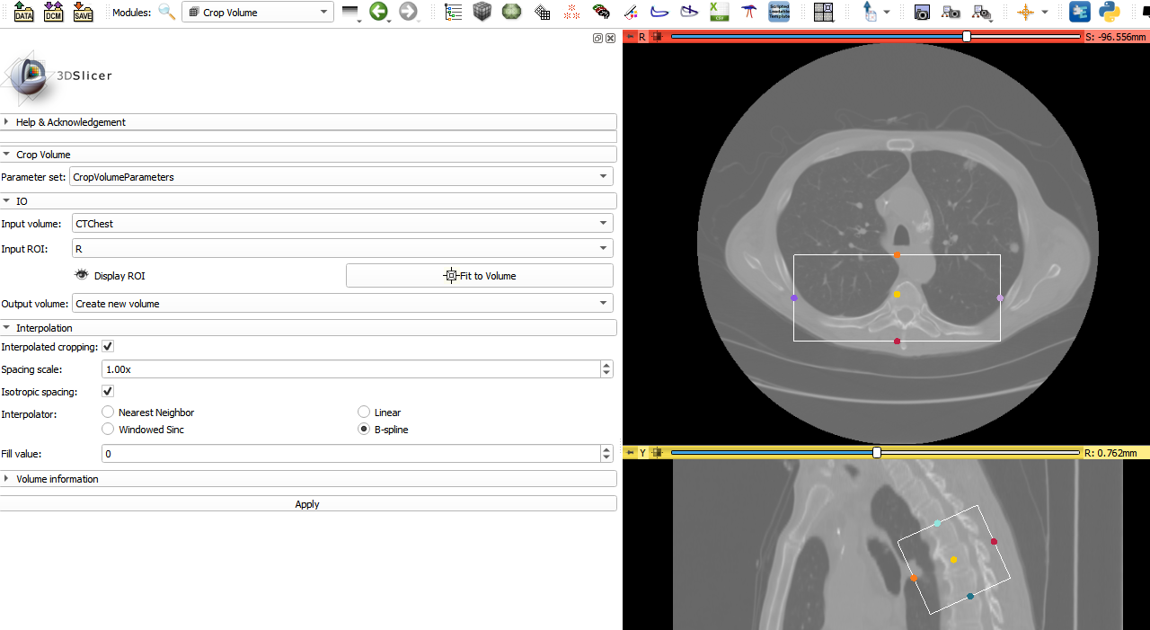 Crop volume with rotated ROI