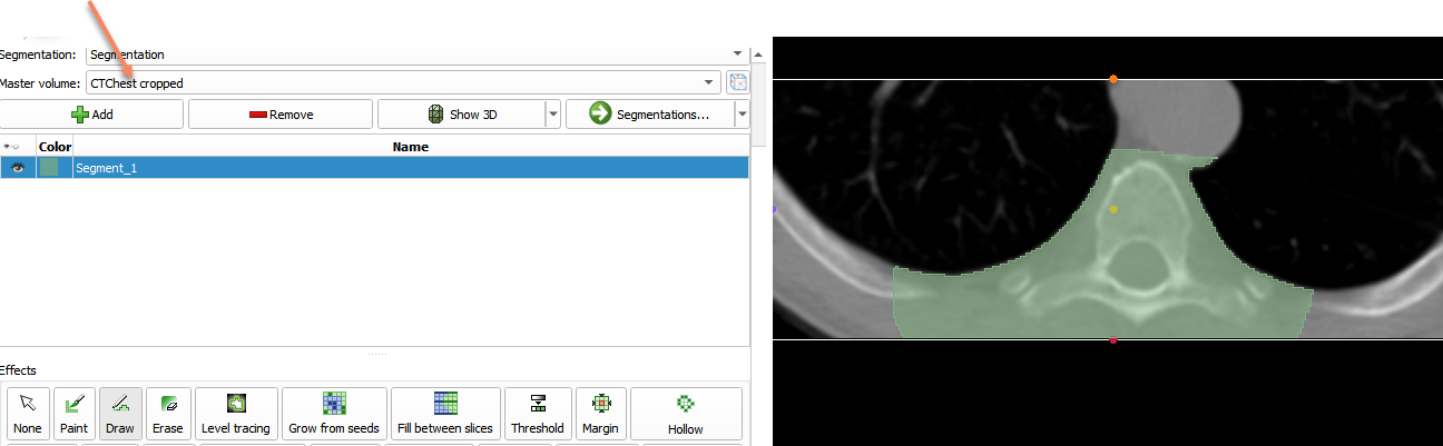 Segment resampled volume