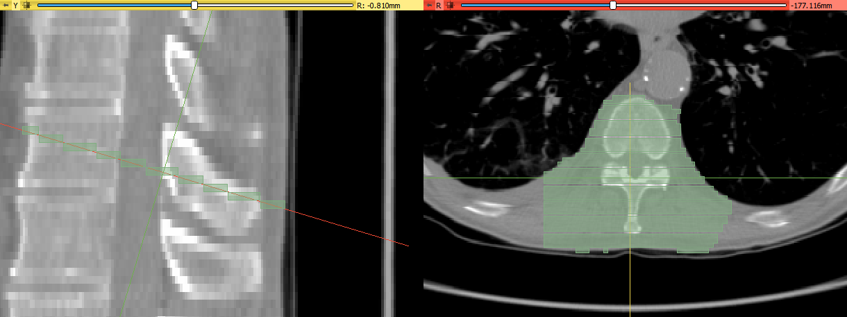 Slice view axes not aligned with segmentation axes