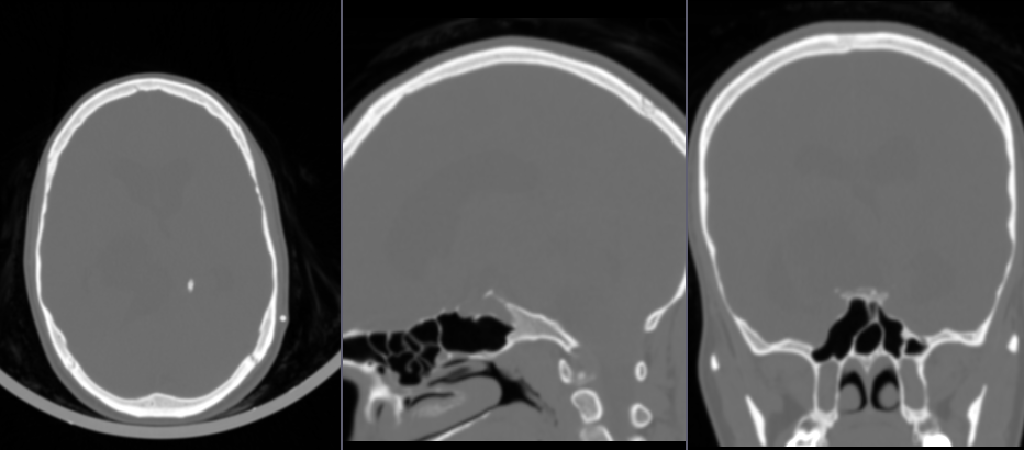 Fading between baseline and contrast images. Significant patient motion is visible.