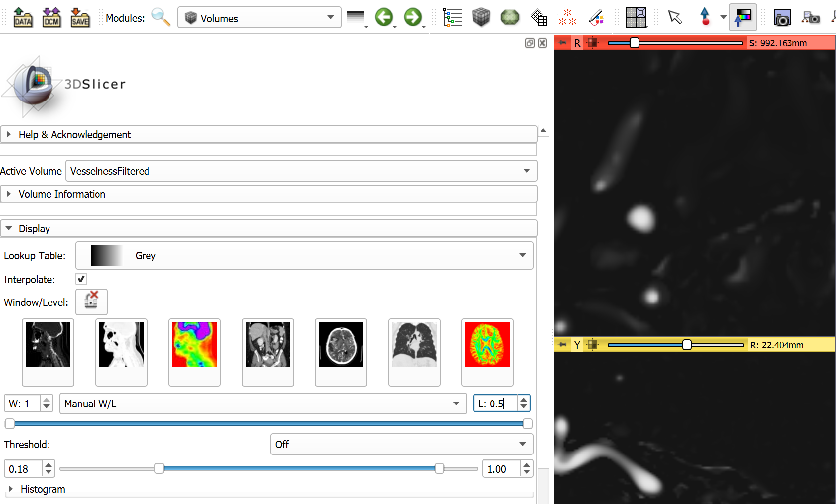 Vesselness filtering final result