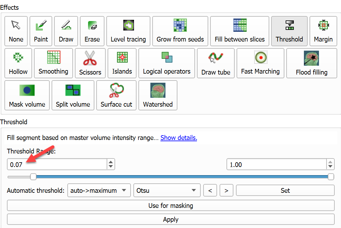 Thresholding settings