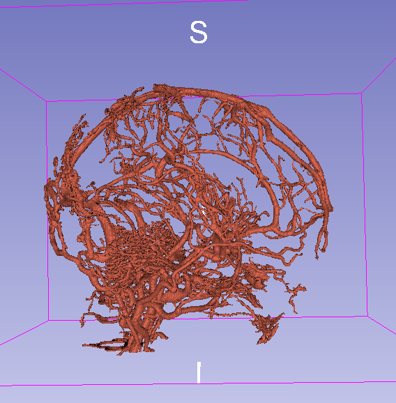 Animation of final result with threshold = 0.07.