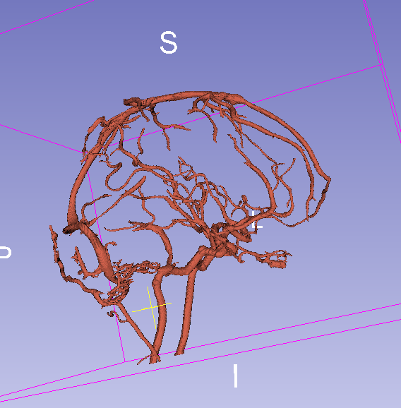 Animation of final result with threshold = 0.15.